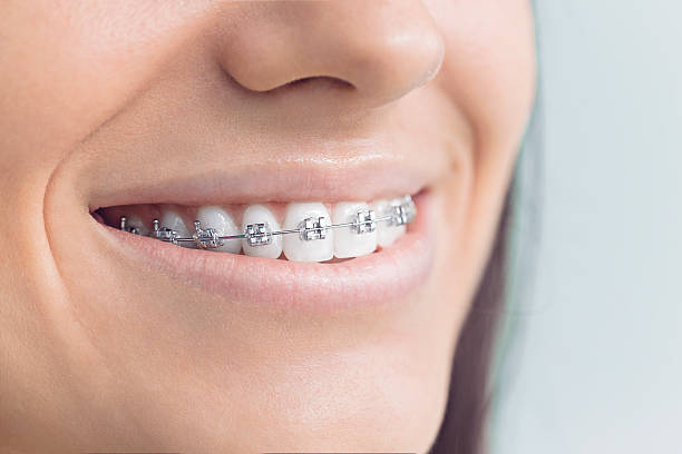 Best Dental Inlays and Onlays  in Vineyards, FL